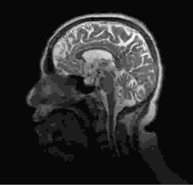 MRI Scan Of A Teenage Brain Showing Increased Activity In The Limbic System Teenagers Translated: A Parent S Survival Guide