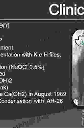 Disinfection Of Root Canal Systems: The Treatment Of Apical Periodontitis